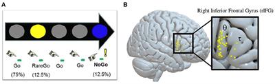 Right inferior frontal gyrus theta-burst stimulation reduces smoking behaviors and strengthens fronto-striatal-limbic resting-state functional connectivity: a randomized crossover trial